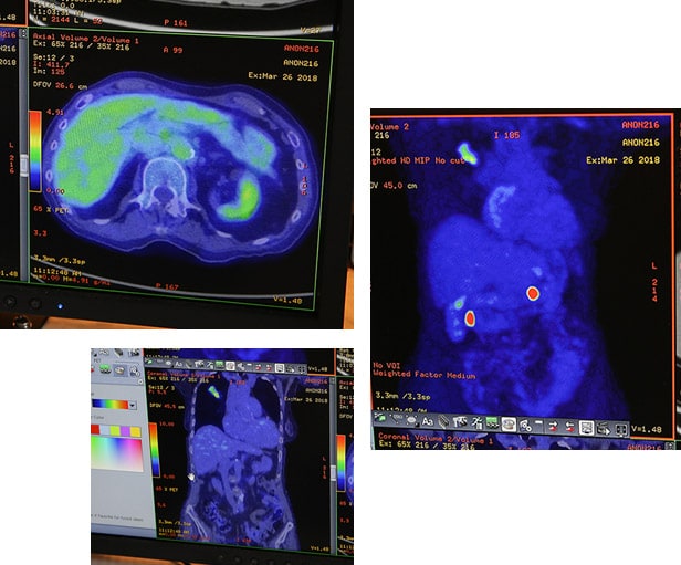 Cancer Diagnostic Imaging